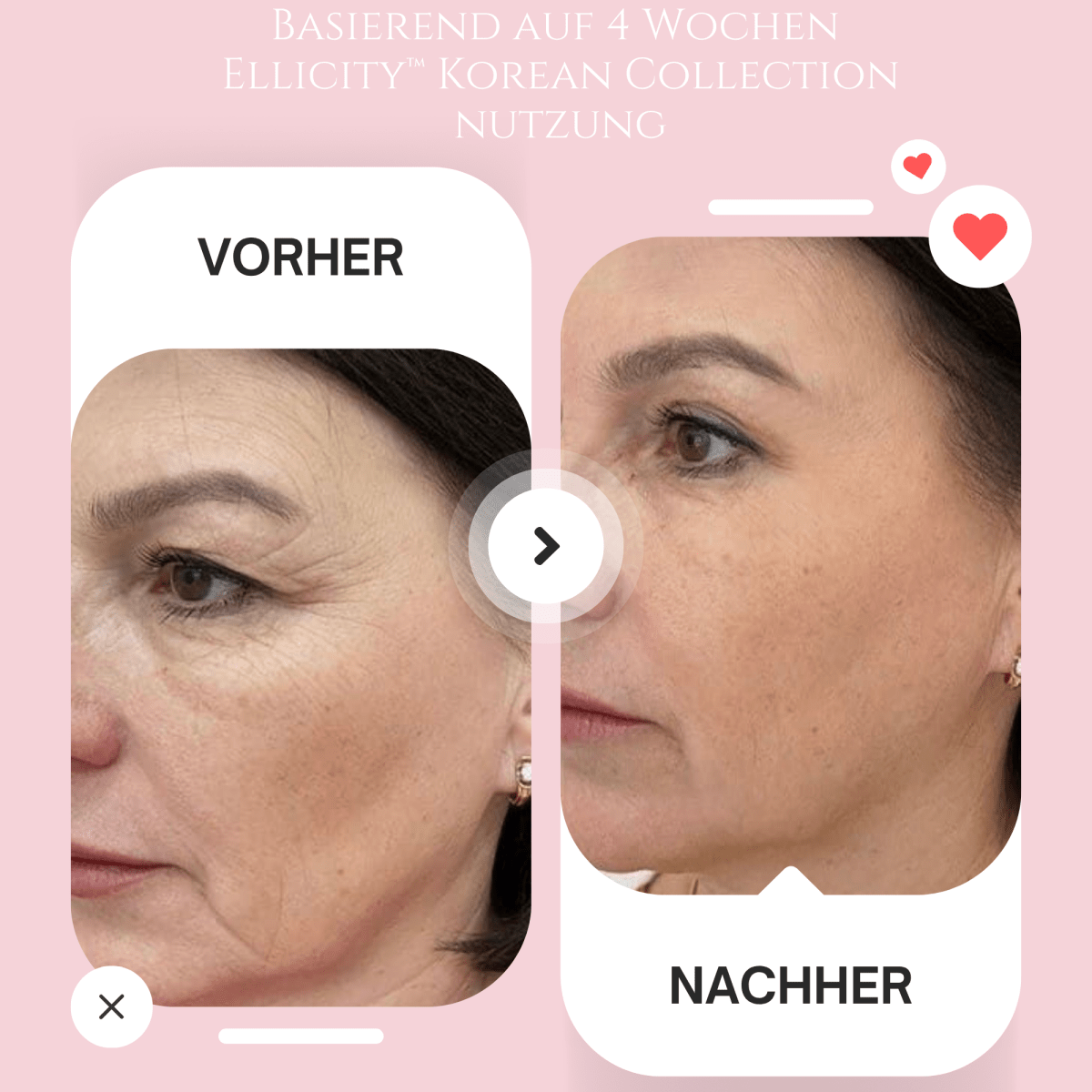 Korean Pink Capsule Cream I Intensiv. Aufbauend. Jugendlich – mit jeder Anwendung sichtbar glattere Haut