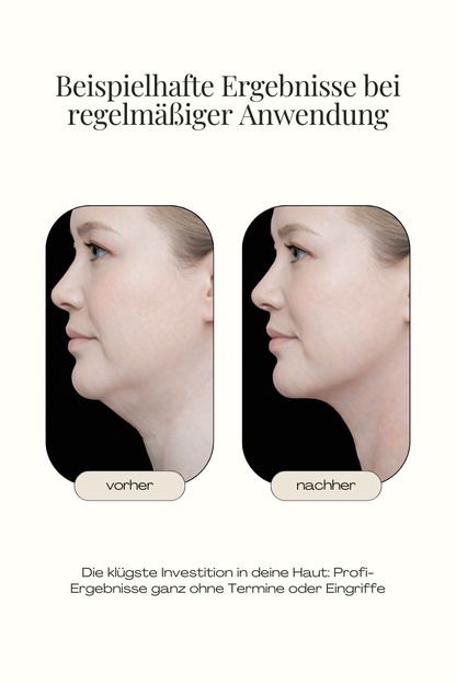 FitFace RF